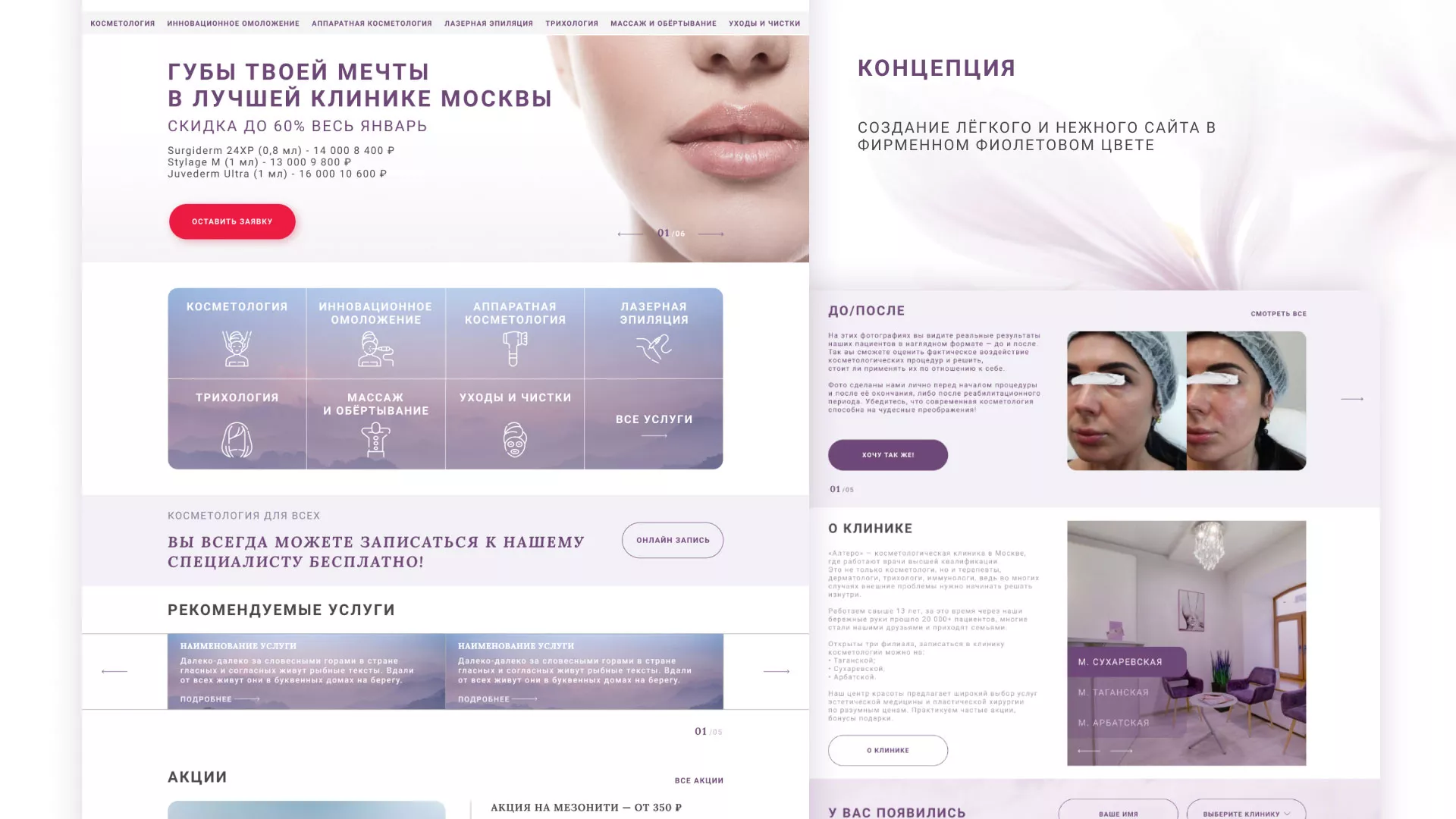 Создание сайта сети клиник эстетической косметологии «Алтеро» в Ивантеевке